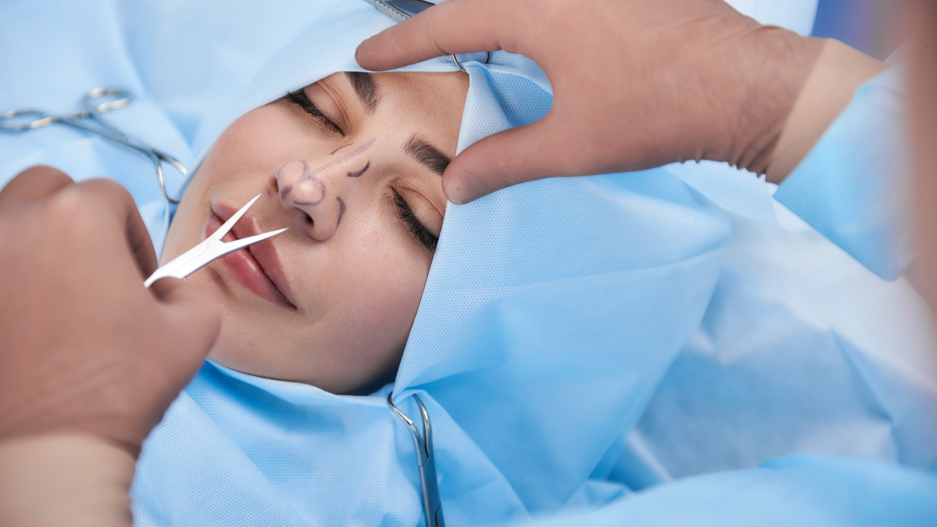 Ultrasonik Rinoplasti Nedir? Nasıl Yapılır?